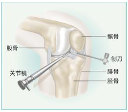 福州哪家医院看痛风好