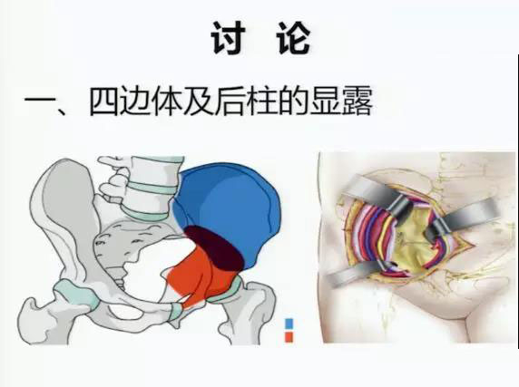 福州治疗髋臼骨折比较好的医院