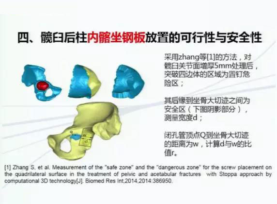 福州治疗髋臼骨折比较好的医院