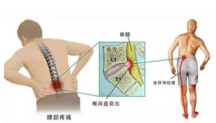 腿疼福州哪个医院看好