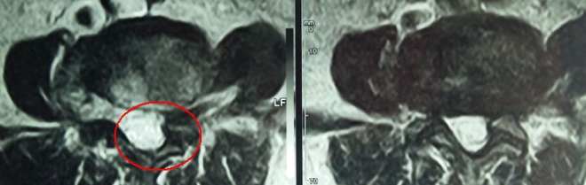 福州看腰腿痛哪家医院好