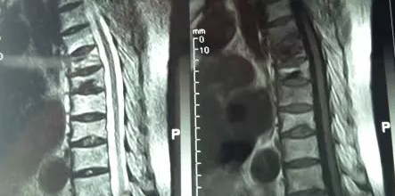 福州看骨折去哪家医院好